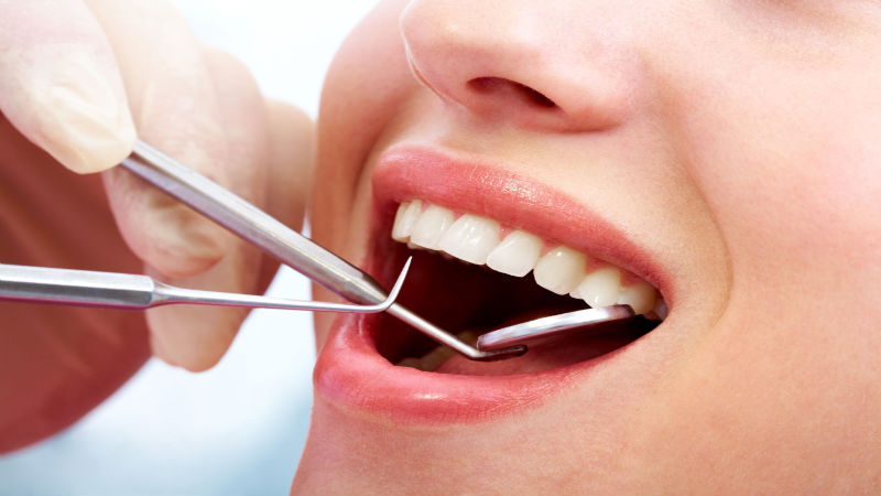 What Are the Benefits of Laser Dentistry?