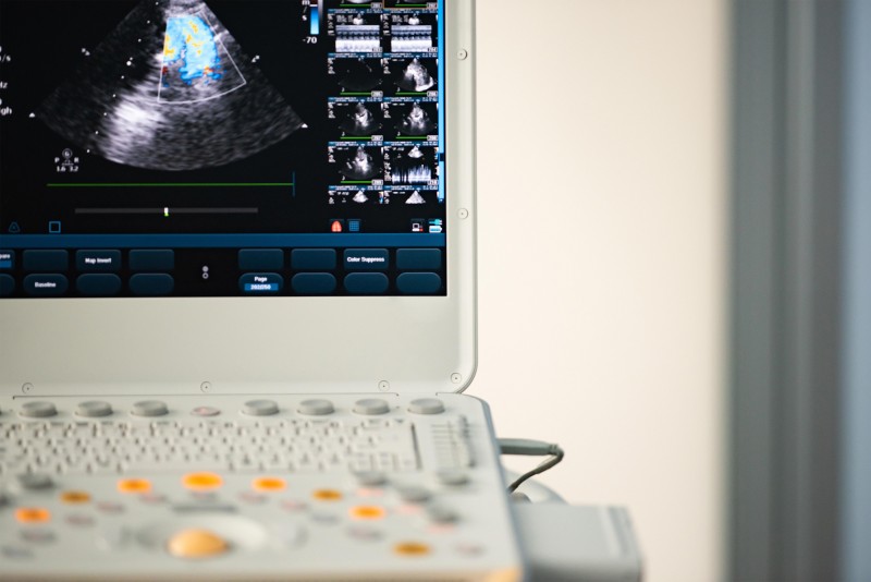 Considerations For Buying GE Ultrasound Machines
