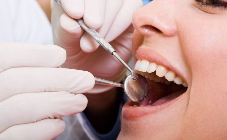 What Are Porcelain Veneers in Lanett, AL?