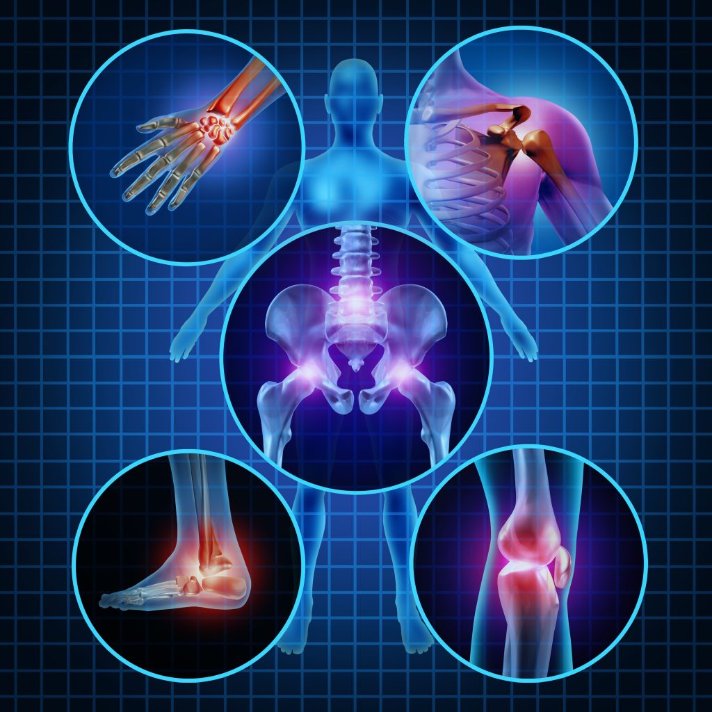 Chiropractic Care for Sciatica: What You Need to Know