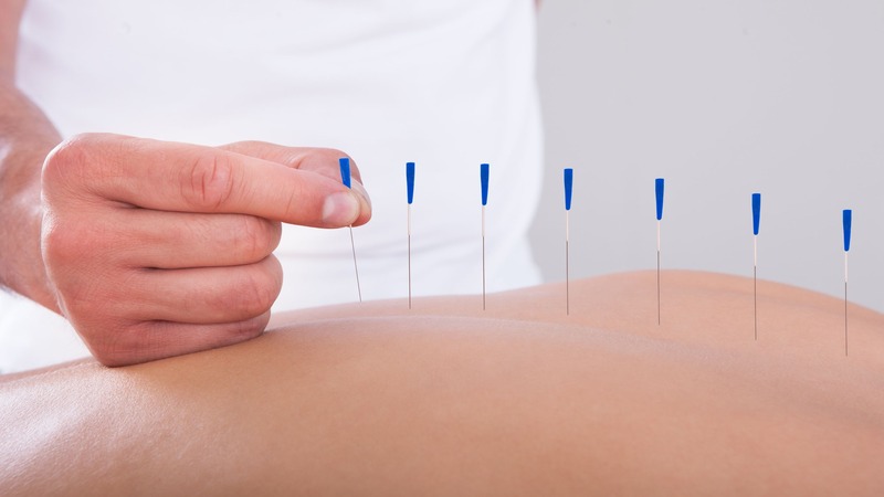 Experience Natural Pain Relief With Acupuncture In Berkeley, CA, For Lasting Wellness