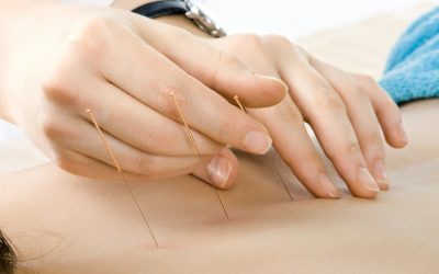 Relieve Chronic Pain With Expert Acupuncture For Pain In Newark, CA: Solutions That Work