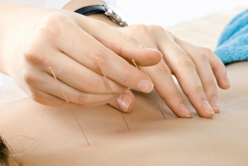 Relieve Chronic Pain With Expert Acupuncture For Pain In Newark, CA: Solutions That Work