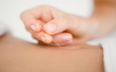 Increase Pregnancy Chances Using Fertility Acupuncture In Westport, CT Techniques