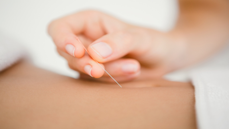 Increase Pregnancy Chances Using Fertility Acupuncture In Westport, CT Techniques