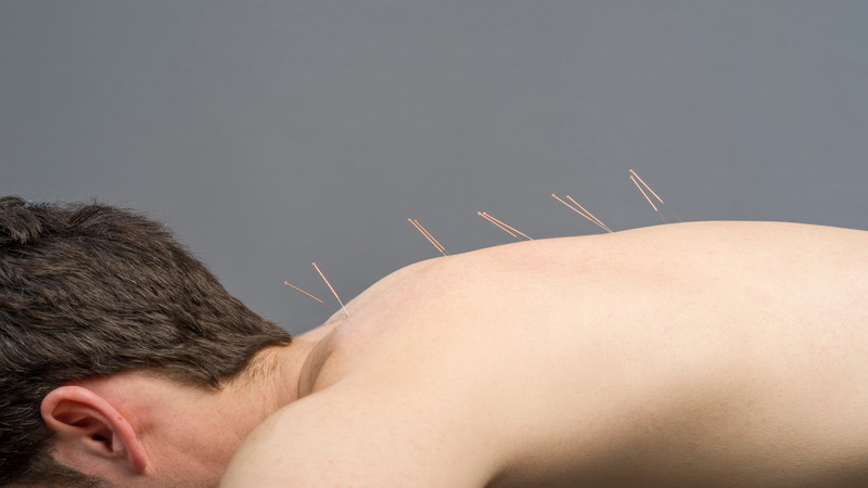 Managing Stress Naturally With Acupuncture For Anxiety In Sudden Valley, WA: Relief Methods