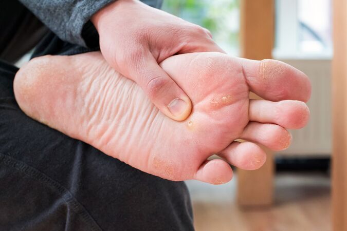 Innovative Solutions for Lasting Plantar Fasciitis Treatment in Long Beach, CA, Patients Need