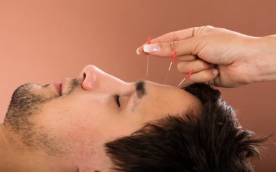 Find Natural Calm and Relief With Acupuncture For Anxiety in Sudden Valley, WA Treatments
